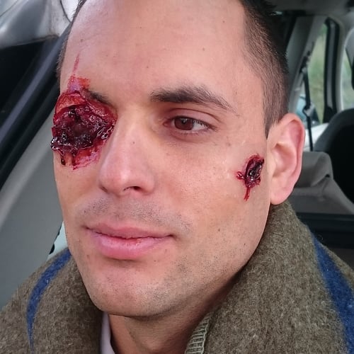 Special forces eye wound