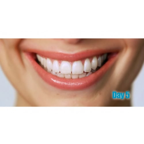 white teeth