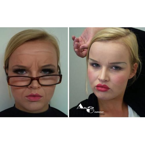 oud / botox