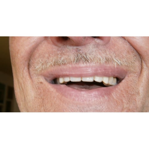 reclamespot Biocura cacaoboter voor de lippen