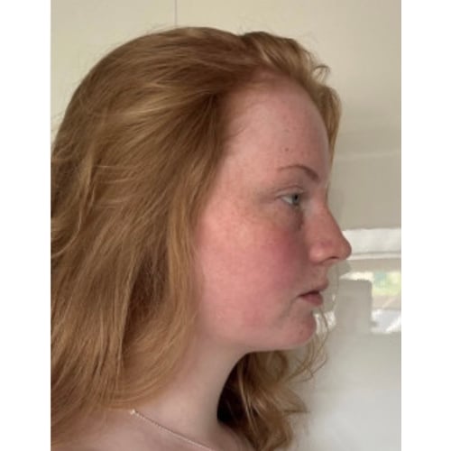 Foto zijaanzicht zonder make up