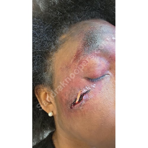 SFX