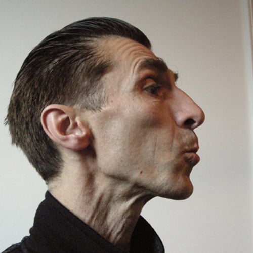 Johannes Hoek