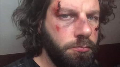 Make-up wounds